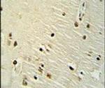 Ku70 Antibody in Immunohistochemistry (IHC)