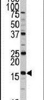 XTP3TPA Antibody in Western Blot (WB)