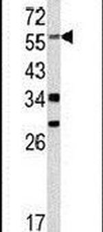 YAP1 Antibody in Western Blot (WB)