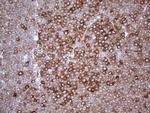 YBX1 Antibody in Immunohistochemistry (Paraffin) (IHC (P))