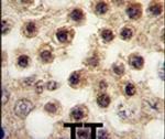 YBX2 Antibody in Immunohistochemistry (IHC)