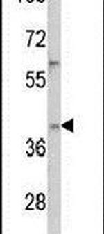 YBX2 Antibody in Western Blot (WB)