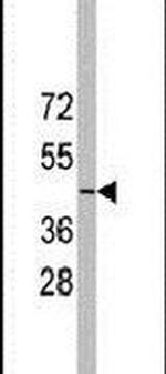 YBX2 Antibody in Western Blot (WB)