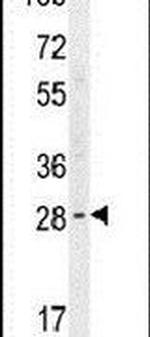 YDJC Antibody in Western Blot (WB)