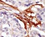 YES1 Antibody in Immunohistochemistry (IHC)