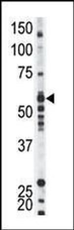 YES1 Antibody in Western Blot (WB)