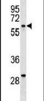 YES1 Antibody in Western Blot (WB)