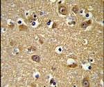 YIPF5 Antibody in Immunohistochemistry (IHC)