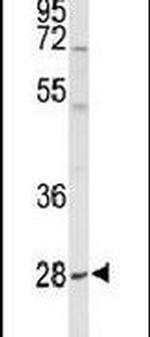 YIPF5 Antibody in Western Blot (WB)