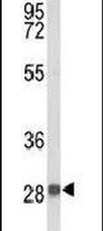 YIPF5 Antibody in Western Blot (WB)