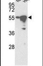 STK25 Antibody in Western Blot (WB)