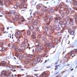 14-3-3 zeta Antibody in Immunohistochemistry (IHC)