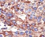 YY1 Antibody in Immunohistochemistry (IHC)