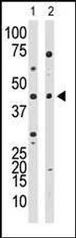 YY1 Antibody in Western Blot (WB)