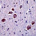 14-3-3 beta Antibody in Immunohistochemistry (IHC)