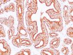 AMACR Antibody in Immunohistochemistry (Paraffin) (IHC (P))