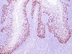 p40 Antibody in Immunohistochemistry (Paraffin) (IHC (P))