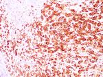 Mammaglobin A Antibody in Immunohistochemistry (Paraffin) (IHC (P))