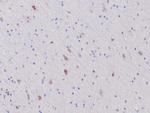 IDH1 (mutant R132H) Antibody in Immunohistochemistry (Paraffin) (IHC (P))