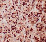 Mammaglobin A Antibody in Immunohistochemistry (Paraffin) (IHC (P))