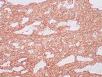 DOG-1 Antibody in Immunohistochemistry (Paraffin) (IHC (P))