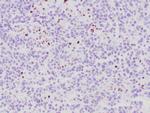 ATRX Antibody in Immunohistochemistry (Paraffin) (IHC (P))