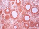 BCL-2 Antibody in Immunohistochemistry (Paraffin) (IHC (P))