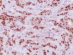 PR Antibody in Immunohistochemistry (Paraffin) (IHC (P))