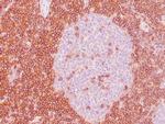 CD43 Antibody in Immunohistochemistry (Paraffin) (IHC (P))