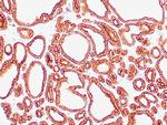 Cytokeratin 18 Antibody in Immunohistochemistry (Paraffin) (IHC (P))