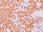 Melan-A Antibody in Immunohistochemistry (Paraffin) (IHC (P))