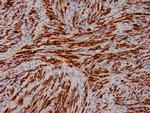 Actin, Smooth Muscle Antibody in Immunohistochemistry (Paraffin) (IHC (P))