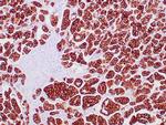 Cytokeratin 7 Antibody in Immunohistochemistry (Paraffin) (IHC (P))