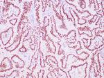 TTF-1/NKX2.1 Antibody in Immunohistochemistry (Paraffin) (IHC (P))
