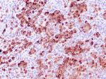 Tyrosinase Antibody in Immunohistochemistry (Paraffin) (IHC (P))