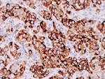 Melanosome Antibody in Immunohistochemistry (Paraffin) (IHC (P))