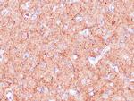 Neurofilament Antibody in Immunohistochemistry (Paraffin) (IHC (P))
