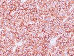 CD45RB Antibody in Immunohistochemistry (Paraffin) (IHC (P))