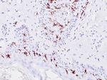 CD1a Antibody in Immunohistochemistry (Paraffin) (IHC (P))