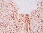 Glypican 3 Antibody in Immunohistochemistry (Paraffin) (IHC (P))