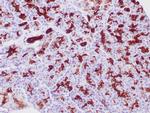 Cytokeratin 19 Antibody in Immunohistochemistry (Paraffin) (IHC (P))
