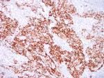 CD31 Antibody in Immunohistochemistry (Paraffin) (IHC (P))