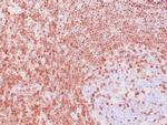 p27kip1 Antibody in Immunohistochemistry (Paraffin) (IHC (P))