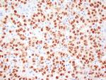 MiTF Antibody in Immunohistochemistry (Paraffin) (IHC (P))
