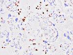 p57 Kip2 Antibody in Immunohistochemistry (Paraffin) (IHC (P))