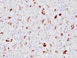 MDM2 Antibody in Immunohistochemistry (Paraffin) (IHC (P))