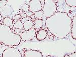 PAX-8 Antibody in Immunohistochemistry (Paraffin) (IHC (P))