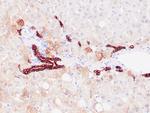 Cytokeratin 8/18 Antibody in Immunohistochemistry (Paraffin) (IHC (P))