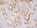 Cytokeratin 17 Antibody in Immunohistochemistry (Paraffin) (IHC (P))