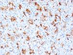 RCC Antibody in Immunohistochemistry (Paraffin) (IHC (P))